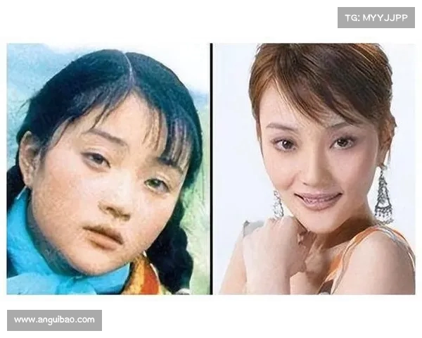 青蛙眼与锥子脸,整容文化对影视作品的负面影响探讨 青蛙眼与锥子脸,整容文化对影视作品的负面影响探讨